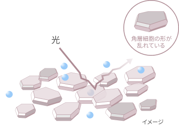  角層細胞の形が乱れている