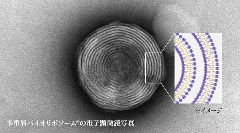 多重層バイオリポソームの電子顕微鏡写真
